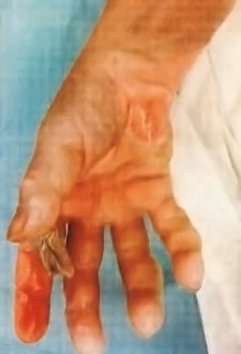Hand