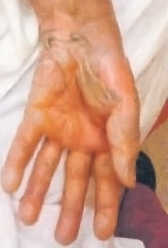 Hand